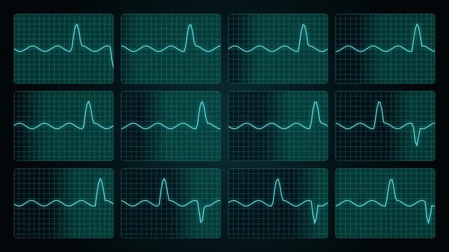 Medical EKG Telemetry Grid Neon Heartbeat Pulse Seamless Loop