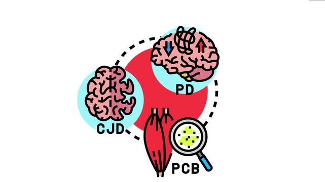 Prions causing various neurodegenerative conditions like creutzfeldt jakob disease and parkinson's disease, showing affected brains, muscles, and cellular contamination