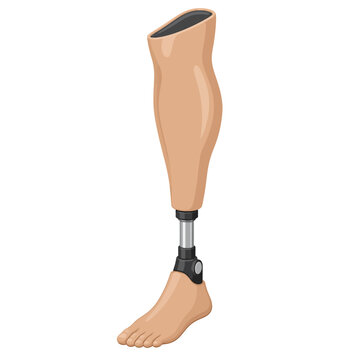 Natural Cosmetic Prosthetic Leg Flat Vector Illustration