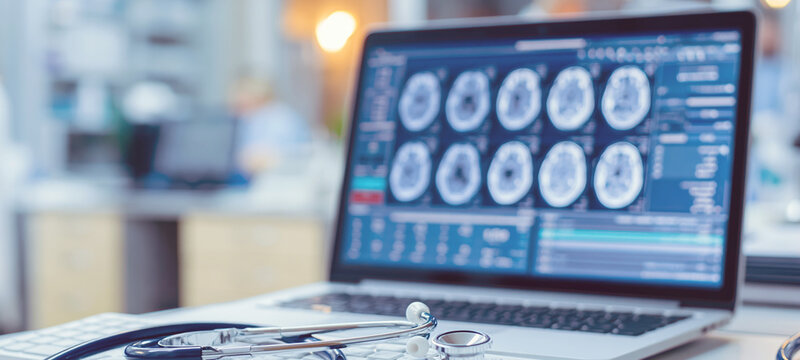 Laptop displaying brain MRI images beside a stethoscope, supporting neurological diagnosis and digital healthcare analysis