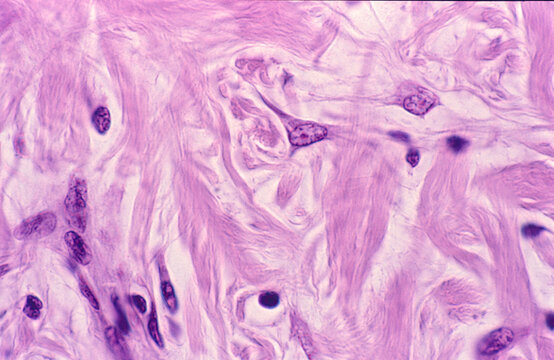 Connective tissue fibroblasts