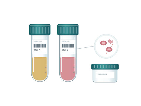 Serum sample tubes with cell detail and specimen container