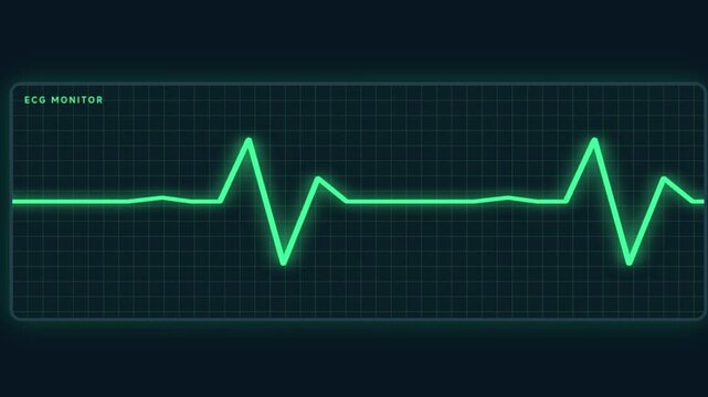 Looping animation of a glowing green ECG heartbeat line scrolling across a dark medical monitor with a grid. Suitable for healthcare, cardiology and vital signs themes.