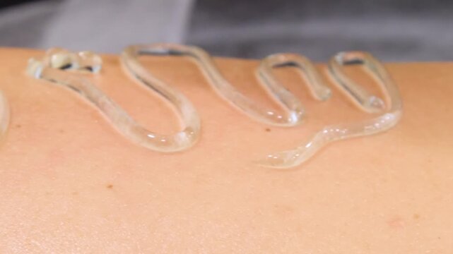 Professional body shaping therapy with vibromassage thermo vacuum and bioelectrical stimulation in beauty salon. 