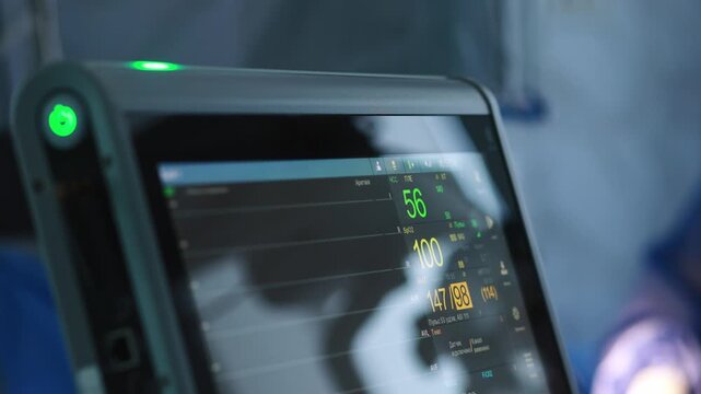 Front view of hospital monitoring equipment with live cardiac and oxygen data on screen during operation. Heart health, cardiovascular disease, arrhythmia and hypertension monitoring