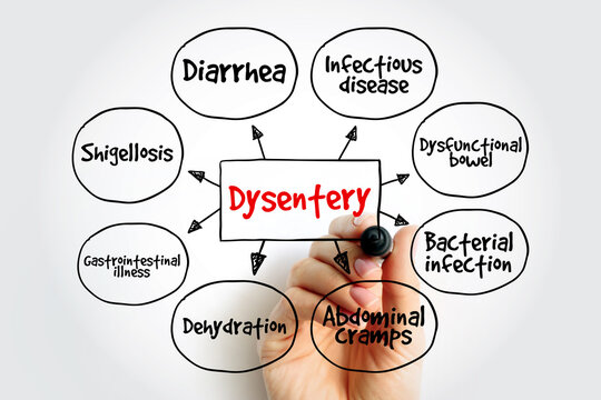 Dysentery medical diagram illustrating symptoms like dehydration and abdominal cramps. Hand drawing infographic of infectious diseases, bacterial infections, and gastrointestinal illness