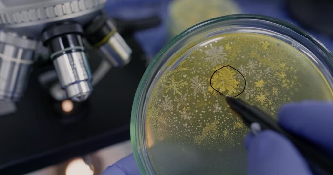 Close-up: a scientist uses a marker to circle bacterial colonies on a Petri dish, which they are holding near a microscope.