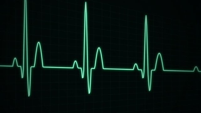 Premium 4K medical ECG cardiac pulse line animation flowing across a 3D perspective grid with glowing green heart rhythm spike waveform, phosphor persistence trail, and electronic hospital monitor sca