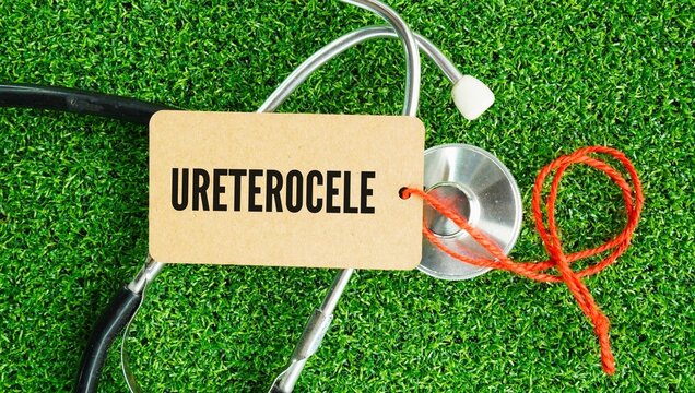Stethoscope and paper tag with the word ureterocele is a congenital birth defect where the lower end of the ureter the tube carrying urine from the kidney to the bladder swells