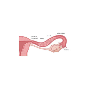 Fallopian Tube Anatomy Vector Illustration Showing the Paired Uterine Tubes Connecting the Ovaries to the Uterus, Including the Infundibulum, Fimbriae, Ampulla, Isthmus, and Intramural Region Involved