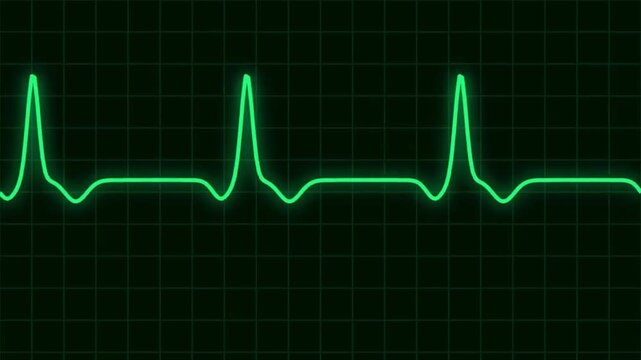 Green ECG Heartbeat Monitor Pulse Line Loop Animation.