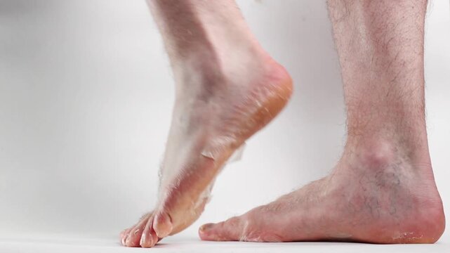 Close-up of a man's legs with peeling skin on the feet. Dry skin on foot sole. White background. Side view. Concept of cosmetic skin care and pedicure