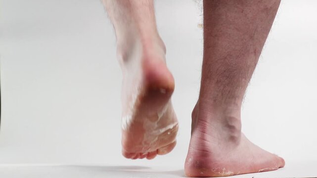 Close-up of a man's legs with peeling skin on the feet. Dry skin and itch of foot sole. White background. Concept of cosmetic skin care and pedicure