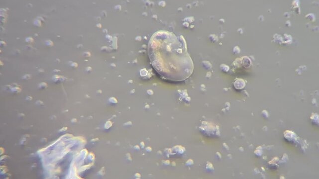 Timelapse of a microscopic amoeba moving and changing shape