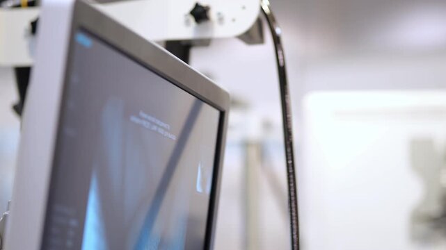 Medical monitor displays X-ray video in clinical setting.\nBlack cable runs beside screen.\nWhite equipment and blurred background visible.\nFocus on monitor's edge and screen reflection.\nNo animals 