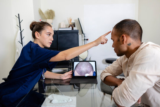 Dermatologist examining male patient for hair loss