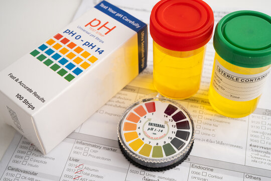 Urinalysis, urine cup with reagent strip pH paper test and comparison chart in laboratory.