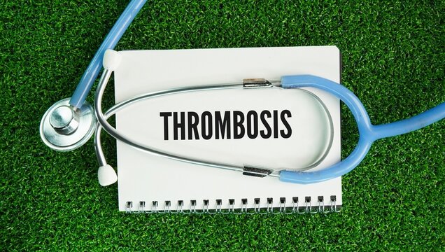 Stethoscope and paper with the word Thrombosis is the formation of a blood clot called a thrombus inside a blood vessel, which slows or completely blocks normal blood flow.