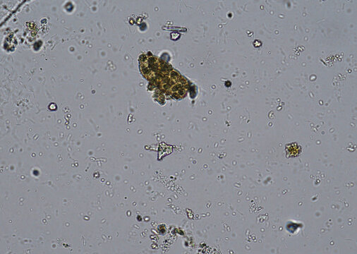 soil microorganisms under a microscope including amoeba, flagellates, nematodes, fungi, bacteria