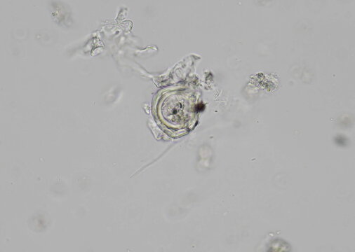 soil microorganisms under a microscope including amoeba, flagellates, nematodes, fungi, bacteria