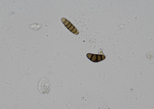 soil microorganisms under a microscope including amoeba, flagellates, nematodes, fungi, bacteria