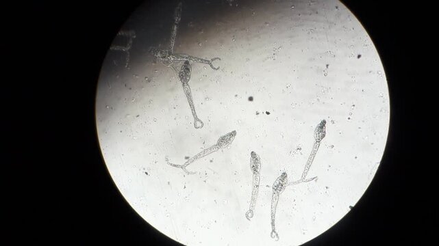 larval stage and cercariae of Schistosoma mansoni, a water borne parasite of humans. observing through microscope