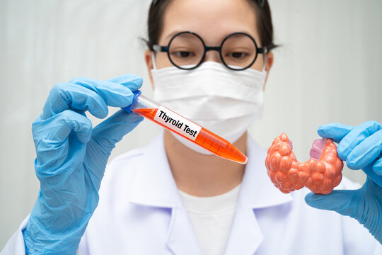 Doctor holding thyroid gland model and blood sample test tube in laboratory.