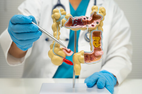 Intestine, doctor holding human model in hospital.