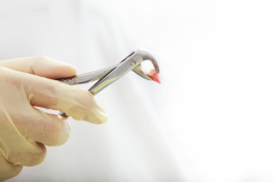 Dentist gloved hand holds extraction forceps with extracted baby tooth. Blood on root. Dental surgery closeup. White background 